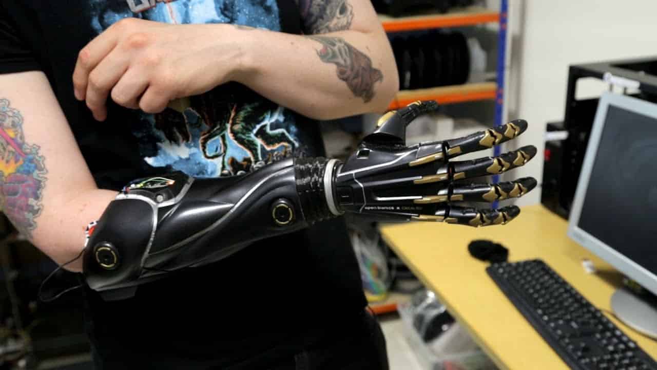 Open Bionics - Protesi Mano Deus EX